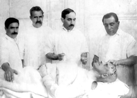 De izquierda a derecha: Enfermero Mateo Pagola, Enfermero Bernardino Núñez, Dr. Antonio Lladó, Dr. Florencio Martínez Rodríguez junto al paciente Manuel Núñez (Rocha, 1915)